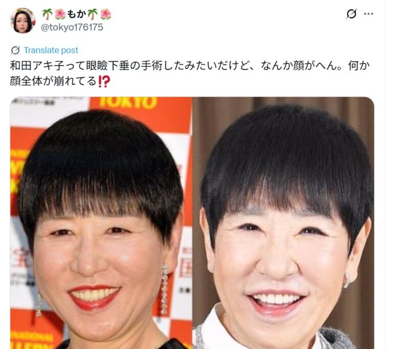 和田アキ子の「現在の姿」に視聴者騒然？顔の変化を巡る噂と、70代後半を迎えた歌姫のリアルな真実
